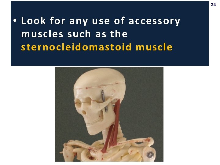 34 • Look for any use of accessory muscles such as the sternocleidomastoid muscle