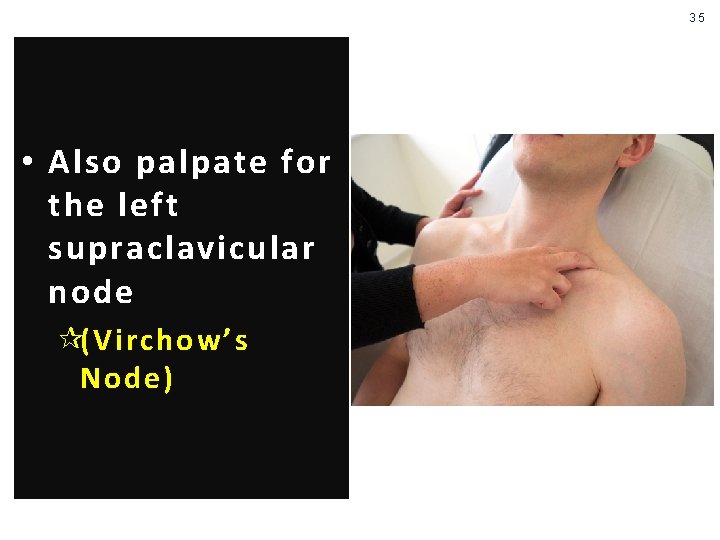 35 • Also palpate for the left supraclavicular node ¶(Virchow’s Node) 