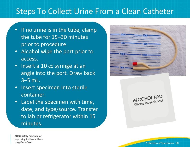 Steps To Collect Urine From a Clean Catheter • If no urine is in