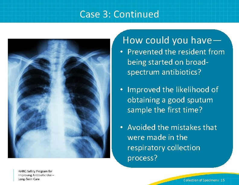 Case 3: Continued How could you have— • Prevented the resident from being started