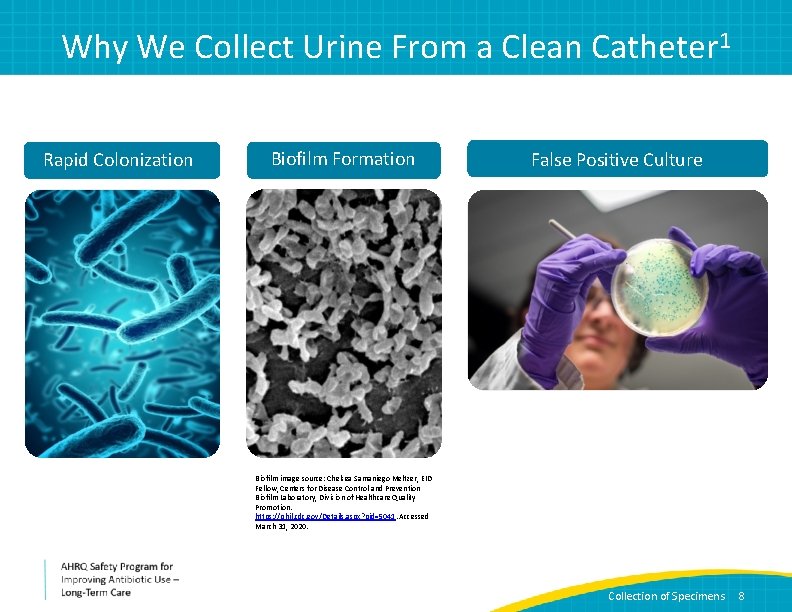 Why We Collect Urine From a Clean Catheter 1 Rapid Colonization Biofilm Formation False