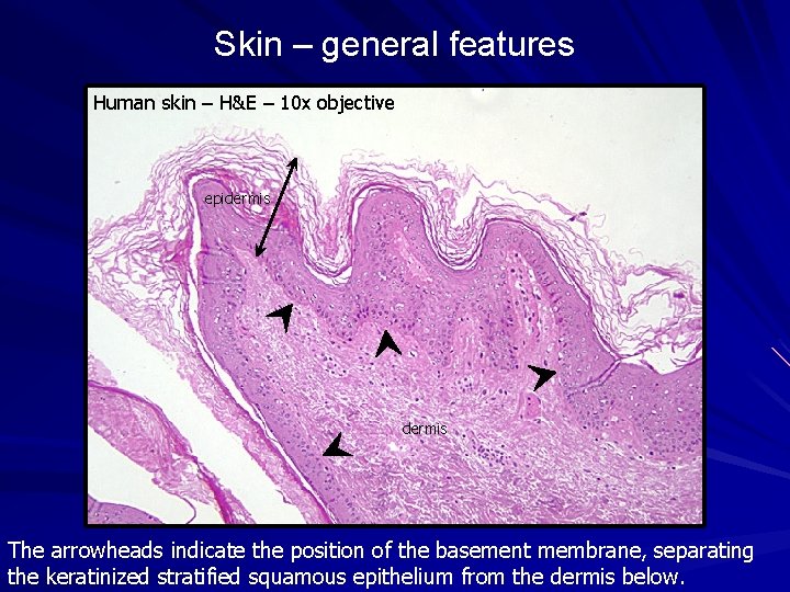 Skin – general features Human skin – H&E – 10 x objective epidermis The