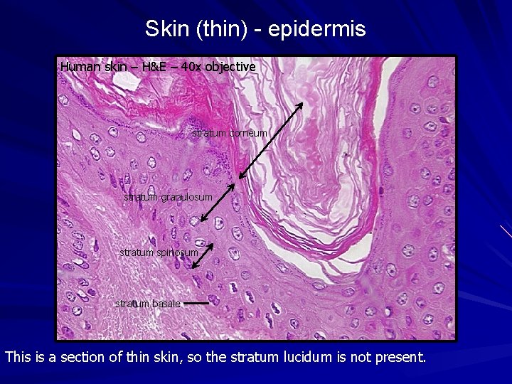 Skin (thin) - epidermis Human skin – H&E – 40 x objective stratum corneum