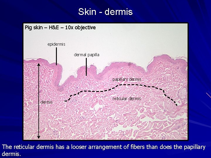 Skin - dermis Pig skin – H&E – 10 x objective epidermis dermal papillary