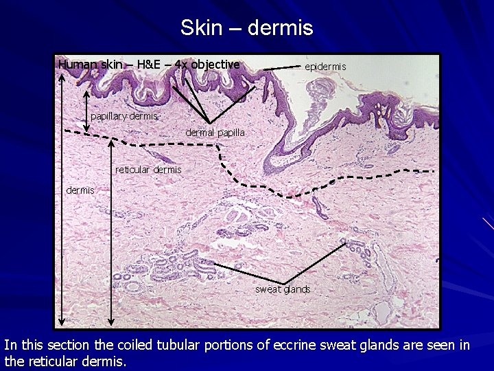 Skin – dermis Human skin – H&E – 4 x objective epidermis papillary dermis