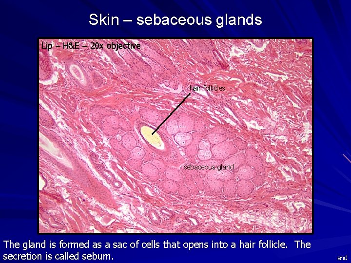 Skin – sebaceous glands Lip – H&E – 20 x objective hair follicles sebaceous