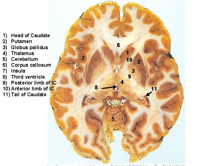 1) Head of Caudate 2) Putamen 3) Globus pallidus 4) Thalamus 5) Cerebellum 6)