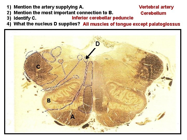 1) 2) 3) 4) Mention the artery supplying A. Vertebral artery Mention the most