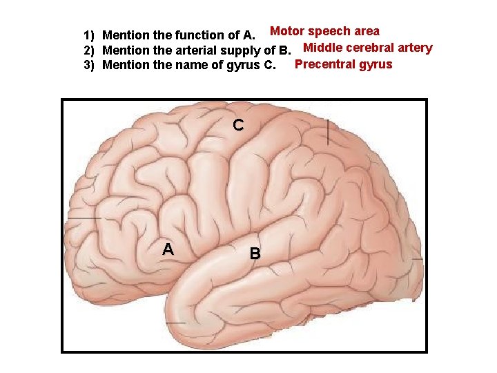 1) Mention the function of A. Motor speech area 2) Mention the arterial supply