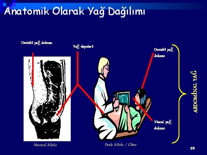 Anatomik Olarak Yağ Dağılımı Yağ depoları Derialtı yağ dokusu ABDOMİNAL YAĞ Derialtı yağ dokusu