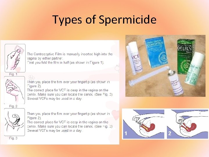 Types of Spermicide 