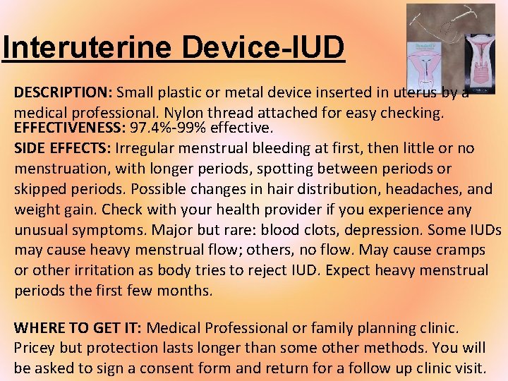 Interuterine Device-IUD DESCRIPTION: Small plastic or metal device inserted in uterus by a medical