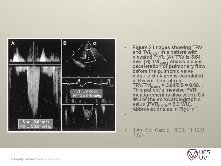  • Figure 2 Images showing TRV and TVIRVOT in a patient with elevated