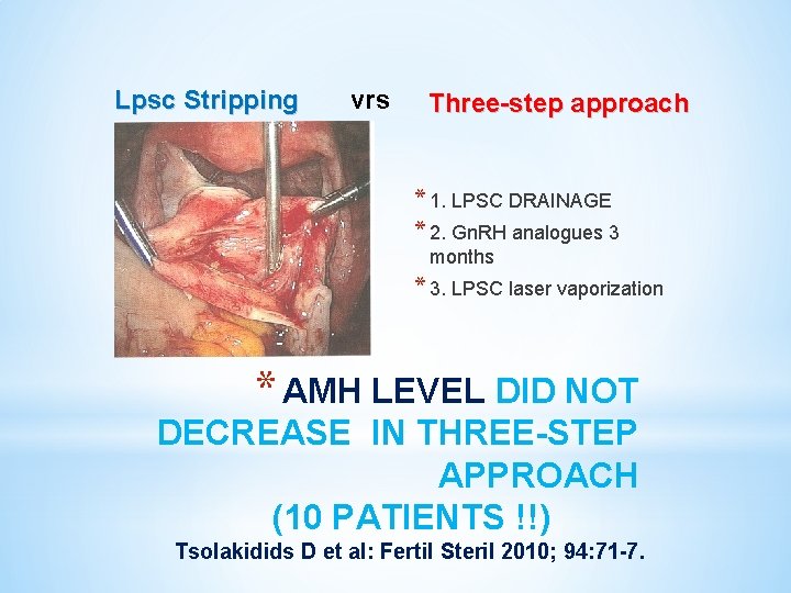 Lpsc Stripping vrs Three-step approach * 1. LPSC DRAINAGE * 2. Gn. RH analogues