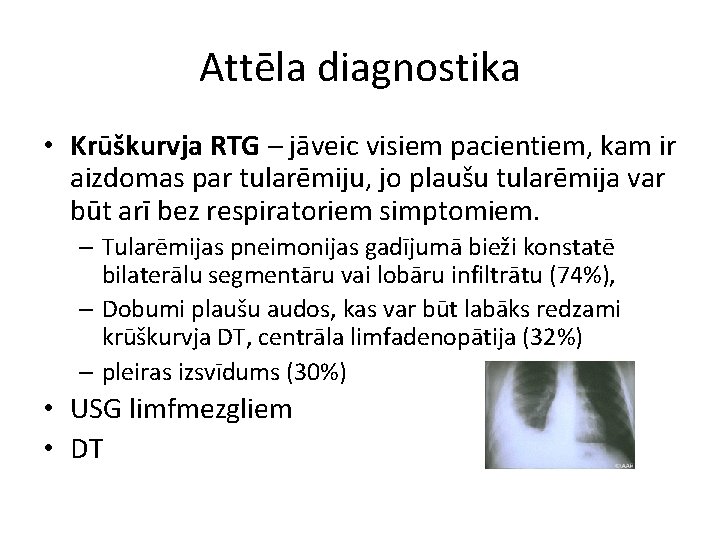 Attēla diagnostika • Krūškurvja RTG – jāveic visiem pacientiem, kam ir aizdomas par tularēmiju,