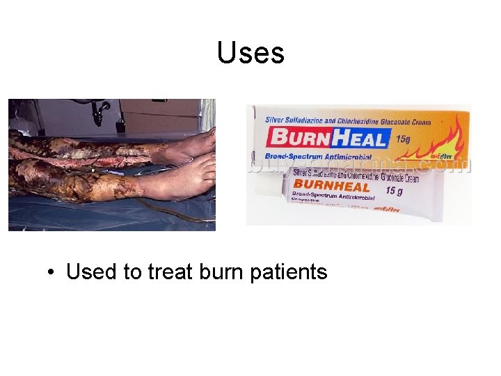 Uses • Used to treat burn patients 