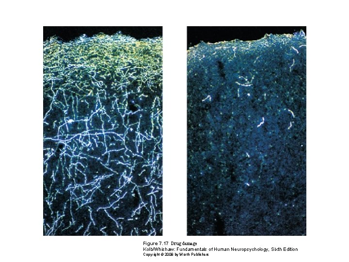 Figure 7. 17 Drug damage Kolb/Whishaw: Fundamentals of Human Neuropsychology, Sixth Edition Copyright ©