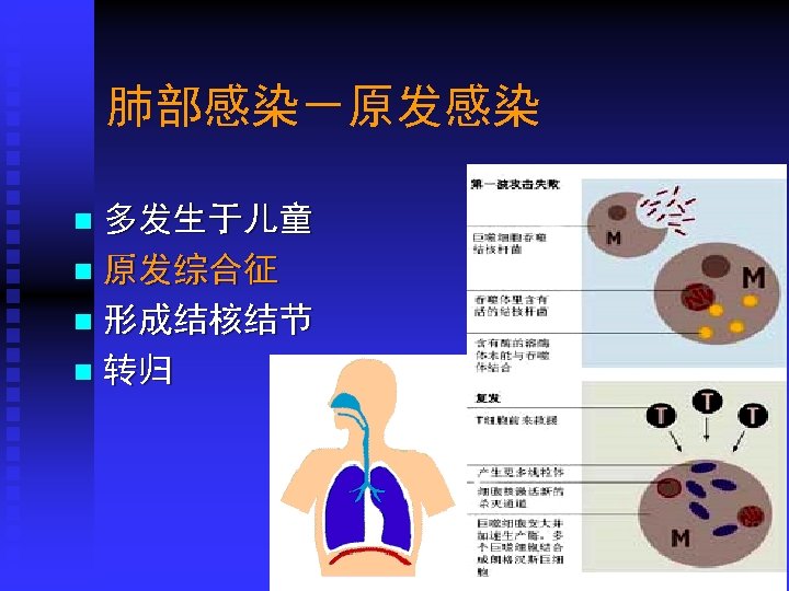 肺部感染－原发感染 多发生于儿童 n 原发综合征 n 形成结核结节 n 转归 n Department of Microbiology, Harbin Medical