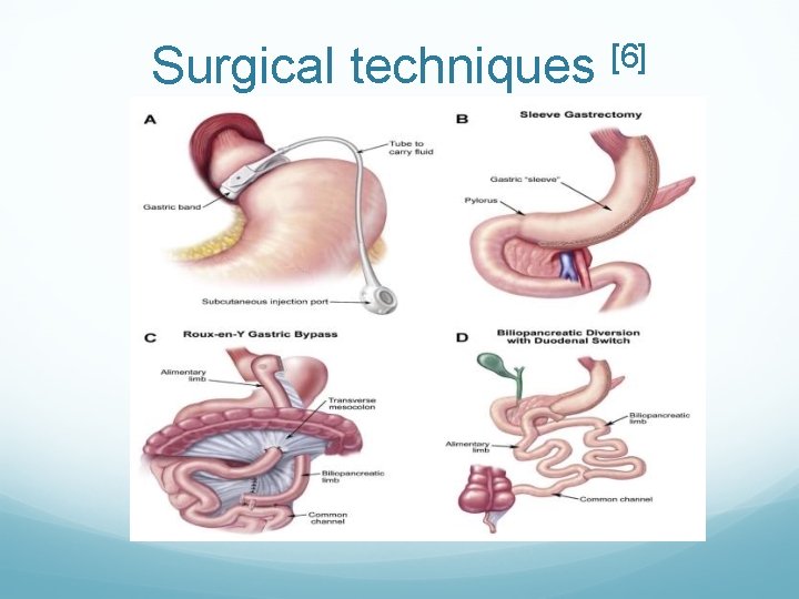 Surgical techniques [6] 