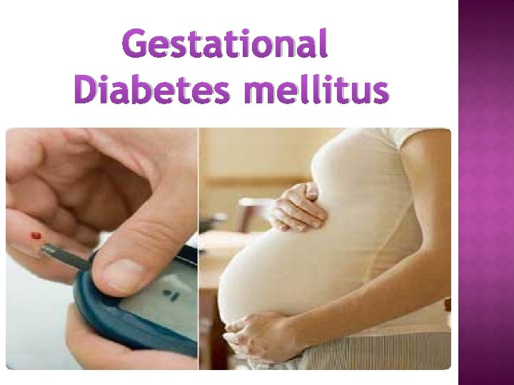 Gestational Diabetes mellitus 