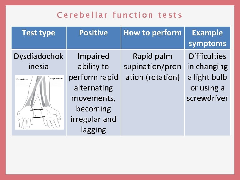 Cerebellar function tests Test type Positive How to perform Example symptoms Dysdiadochok Impaired Rapid