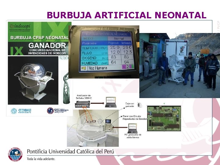 BURBUJA ARTIFICIAL NEONATAL 