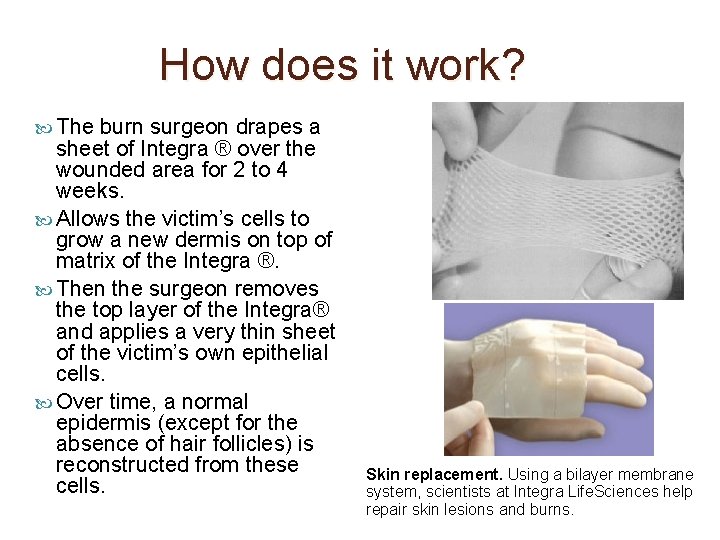 How does it work? The burn surgeon drapes a sheet of Integra ® over