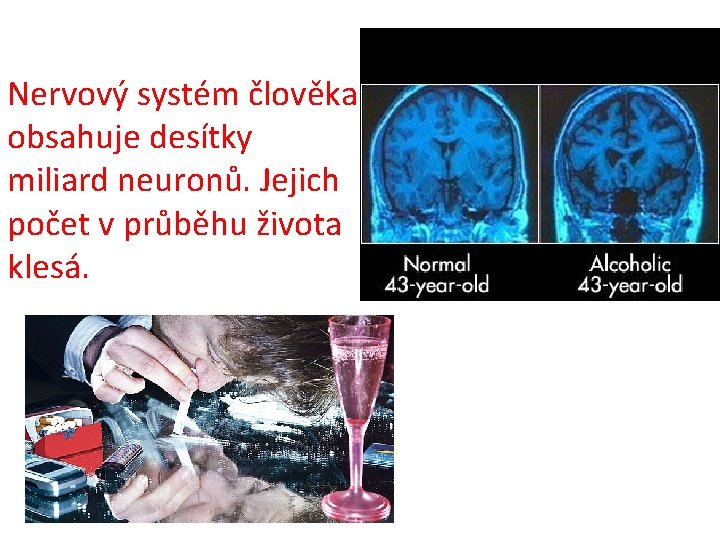 Nervový systém člověka obsahuje desítky miliard neuronů. Jejich počet v průběhu života klesá. 