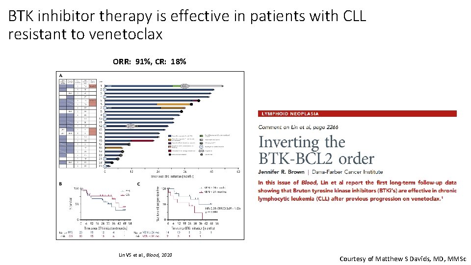 BTK inhibitor therapy is effective in patients with CLL resistant to venetoclax ORR: 91%,