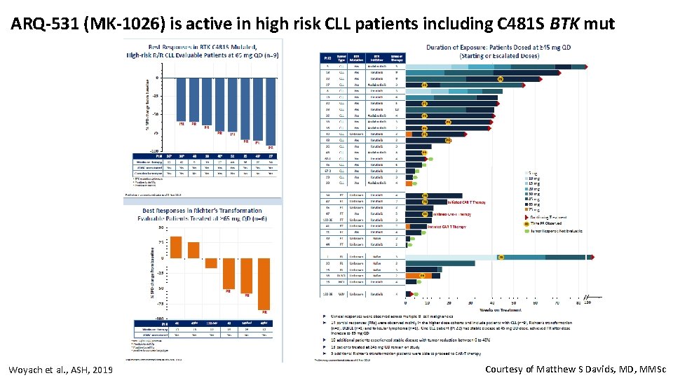 ARQ-531 (MK-1026) is active in high risk CLL patients including C 481 S BTK