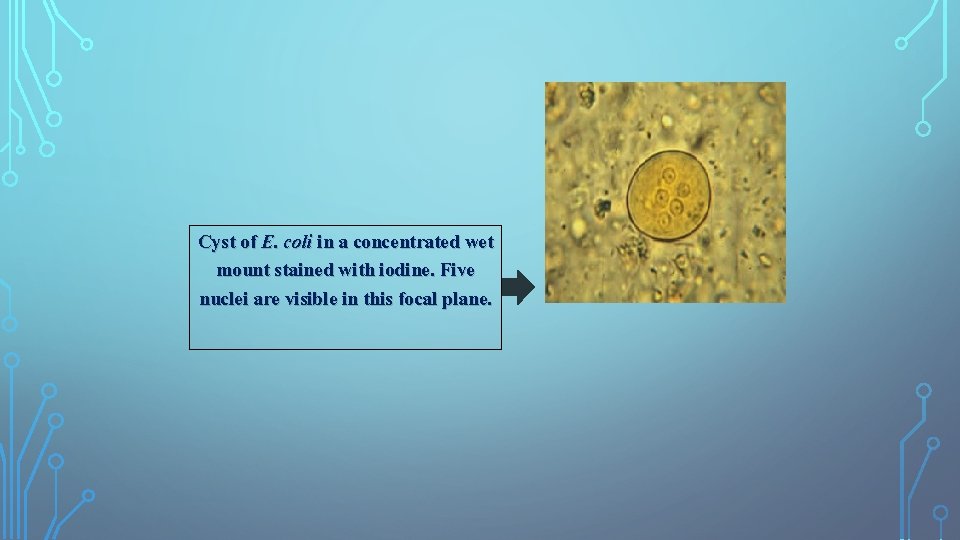 Cyst of E. coli in a concentrated wet mount stained with iodine. Five nuclei