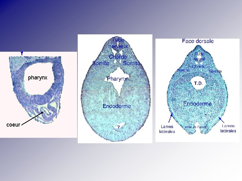 pharynx coeur 