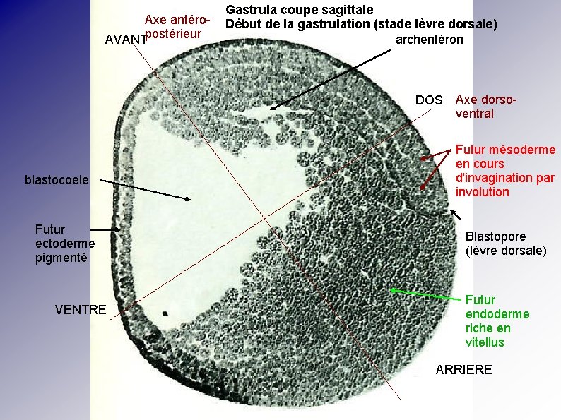 Axe antéro. AVANTpostérieur Gastrula coupe sagittale Début de la gastrulation (stade lèvre dorsale) archentéron