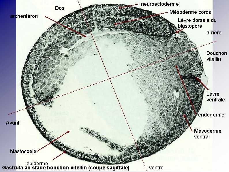 Dos neuroectoderme Mésoderme cordal archentéron Lèvre dorsale du blastopore arrière Bouchon vitellin Lèvre ventrale