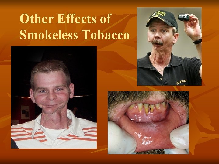 Other Effects of Smokeless Tobacco 