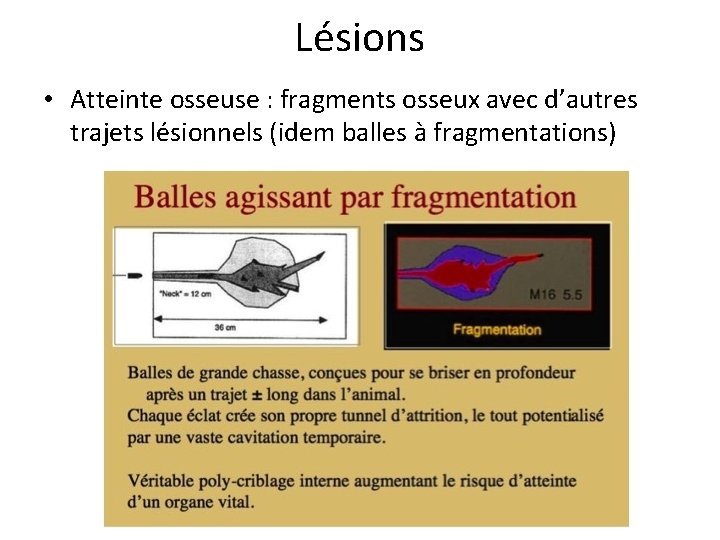 Lésions • Atteinte osseuse : fragments osseux avec d’autres trajets lésionnels (idem balles à