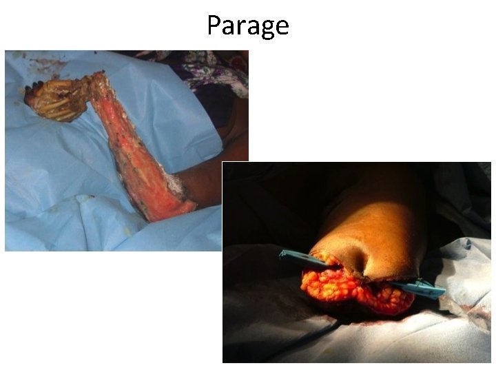 Parage 