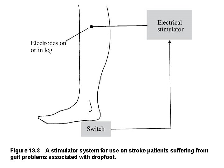 Figure 13. 8 A stimulator system for use on stroke patients suffering from gait