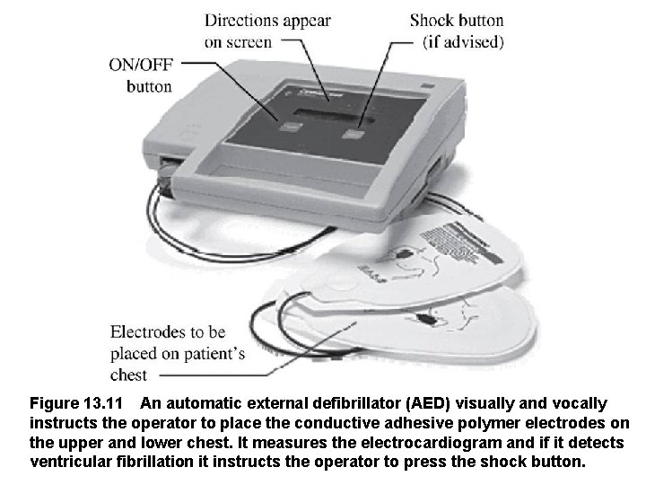 Figure 13. 11 An automatic external defibrillator (AED) visually and vocally instructs the operator
