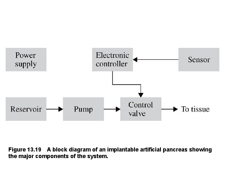 Figure 13. 19 A block diagram of an implantable artificial pancreas showing the major