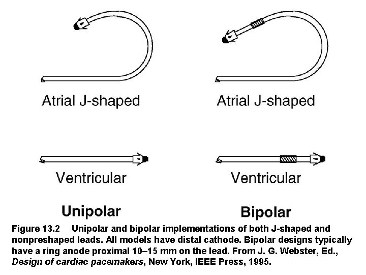 Figure 13. 2 Unipolar and bipolar implementations of both J shaped and nonpreshaped leads.