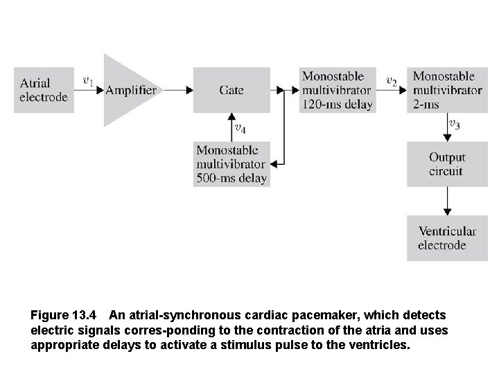Figure 13. 4 An atrial synchronous cardiac pacemaker, which detects electric signals corres ponding