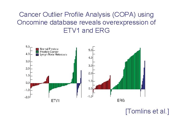 Cancer Outlier Profile Analysis (COPA) using Oncomine database reveals overexpression of ETV 1 and