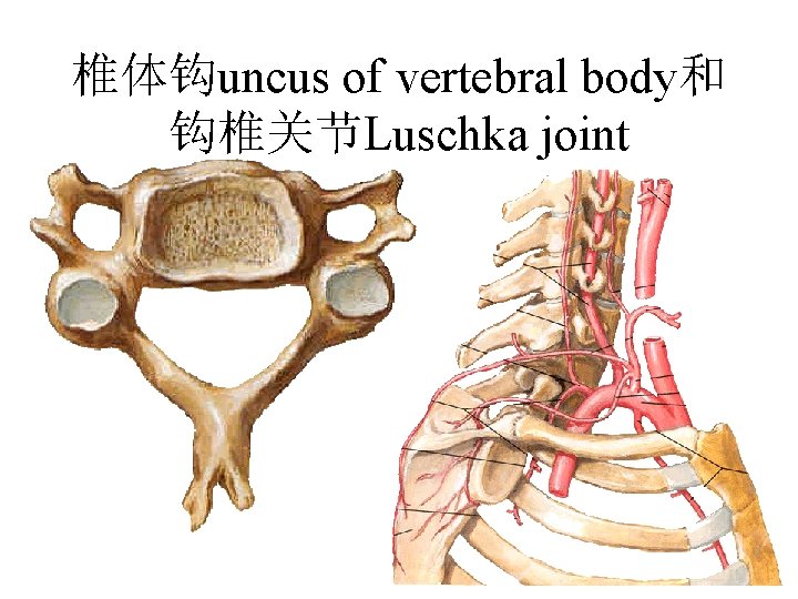 椎体钩uncus of vertebral body和 钩椎关节Luschka joint 椎体钩uncus of vertebral body和 钩椎关节Luschka joint