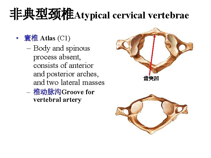 非典型颈椎Atypical cervical vertebrae • 寰椎 Atlas (C 1) – Body and spinous process absent, 非典型颈椎Atypical cervical vertebrae • 寰椎 Atlas (C 1) – Body and spinous process absent,