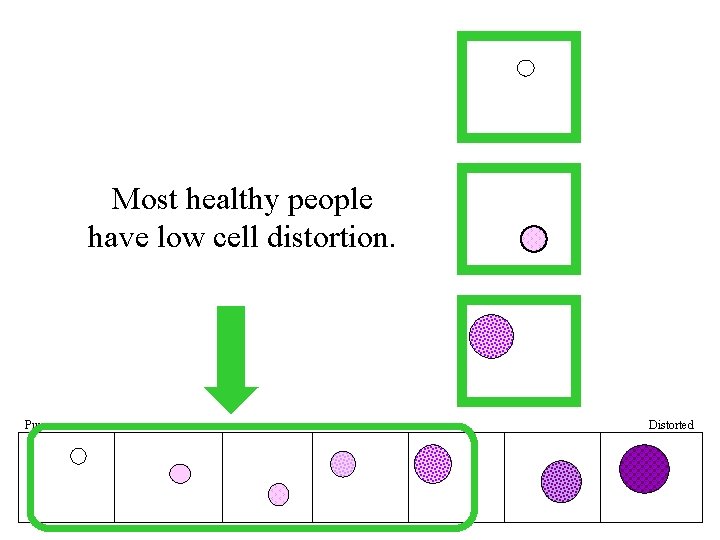 Most healthy people have low cell distortion. Pure Distorted 