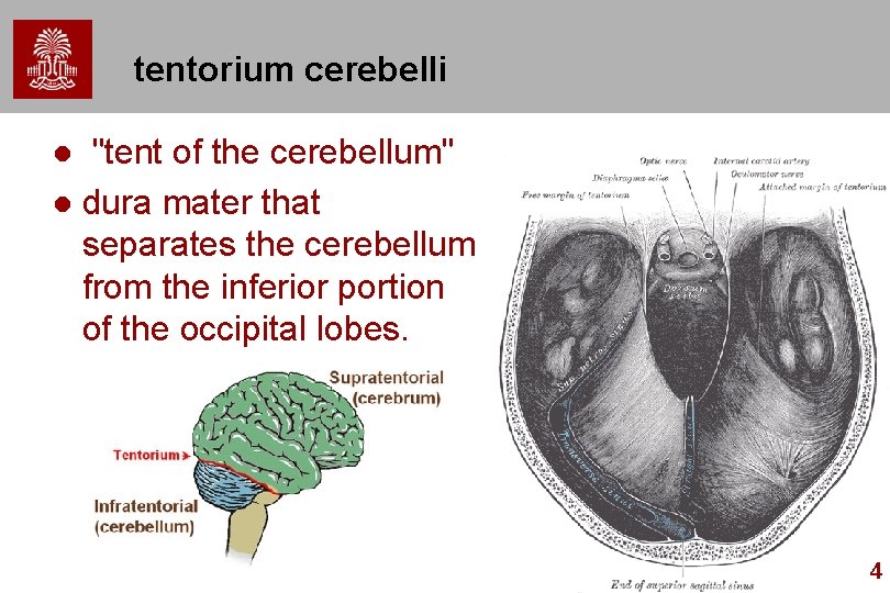 tentorium cerebelli "tent of the cerebellum" l dura mater that separates the cerebellum from