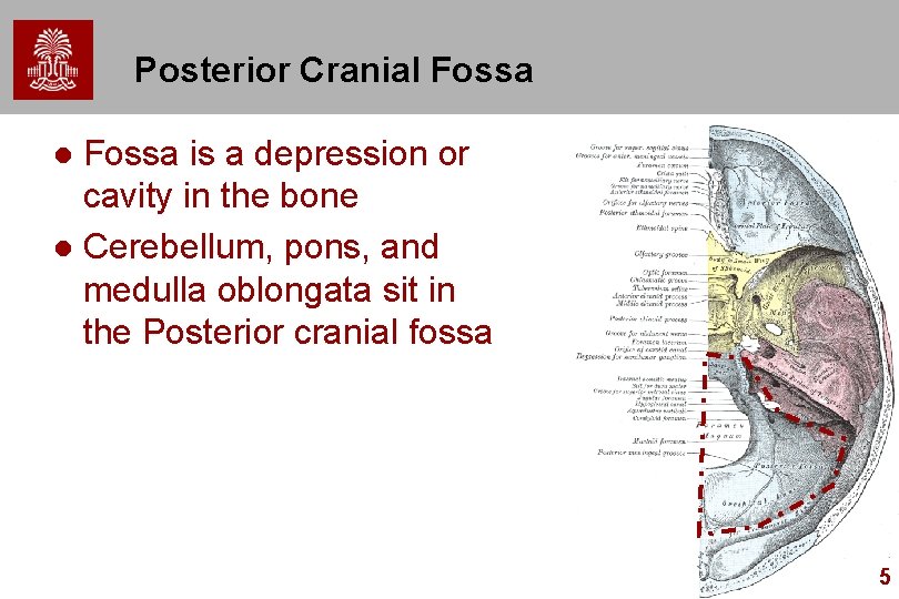 Posterior Cranial Fossa is a depression or cavity in the bone l Cerebellum, pons,