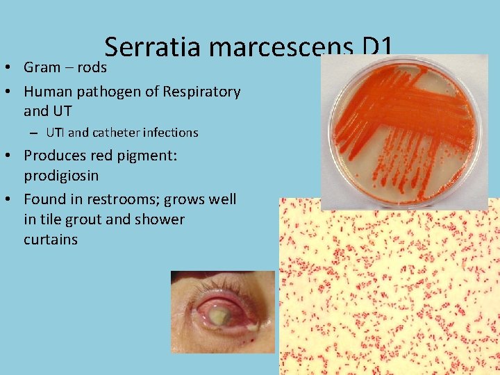 Serratia marcescens D 1 • Gram – rods • Human pathogen of Respiratory and