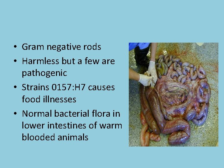  • Gram negative rods • Harmless but a few are pathogenic • Strains